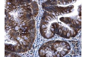 Immunohistochemistry (IHC) image for anti-Transcription Factor A, Mitochondrial (TFAM) antibody (ABIN2855585)