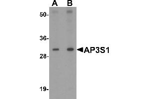 Western blot analysis of AP3S1 in mouse kidney tissue lysate with AP3S1 antibody at (A) 1 and (B) 2 µg/mL . (AP3S1 antibody  (Middle Region))