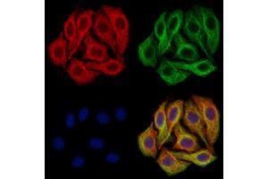 ABIN7094530 and ABIN7098579 staining Hela cells by IF/ICC. (Glutaminase antibody  (C-Term))