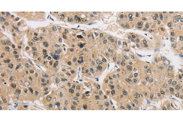 AMZ2 antibody