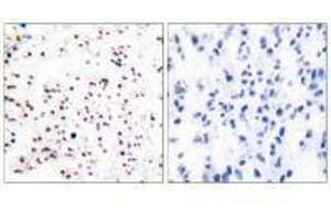 Immunohistochemical analysis of paraffin-embedded human tonsil tissue using MCM5 antibody. (MCM5 antibody)