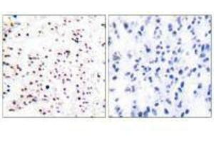 Immunohistochemical analysis of paraffin-embedded human tonsil tissue using MCM5 antibody. (MCM5 antibody)