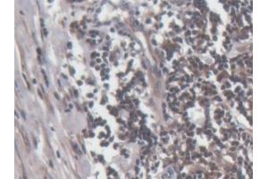 Detection of PRF1 in Human Lymph node Tissue using Polyclonal Antibody to Perforin 1 (PRF1) (Perforin 1 antibody  (AA 32-316))
