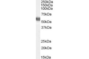 Image no. 1 for anti-Glucose-6-Phosphate Dehydrogenase (G6PD) (AA 308-320), (Internal Region) antibody (ABIN374790) (Glucose-6-Phosphate Dehydrogenase antibody  (Internal Region))