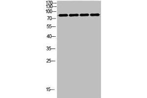 Western Blot analysis of customer's using FOXP1 Antibody Polyclonal Antibody. (FOXP1 antibody  (C-Term))