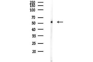 anti-serine/threonine Kinase 32C (STK32C) (Internal Region) antibody