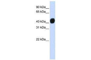 Western Blotting (WB) image for anti-Transforming Growth Factor beta 1 Induced Transcript 1 (TGFB1I1) antibody (ABIN2458370) (TGFB1I1 antibody)