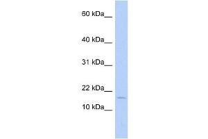 ISCA2 antibody used at 1 ug/ml to detect target protein. (ISCA2 antibody)