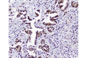 IHC analysis of TPR using anti-TPR antibody (ABIN5693275). (TPR antibody)