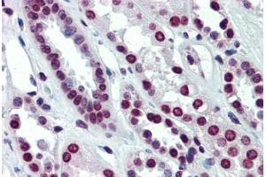 Human Kidney (formalin-fixed, paraffin-embedded) stained with ARID5A antibody ABIN462249 followed by biotinylated goat anti-rabbit IgG secondary antibody ABIN481713, alkaline phosphatase-streptavidin and chromogen. (ARID5A antibody  (C-Term))