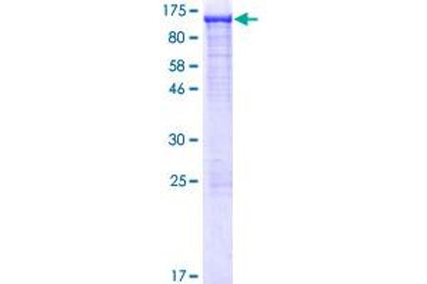 Aconitase 1 Protein (ACO1) (AA 1-889) (GST tag)