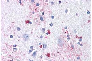 Anti-ENT1 antibody  ABIN1048564 IHC staining of human brain, cortex. (SLC29A1 antibody  (Internal Region))