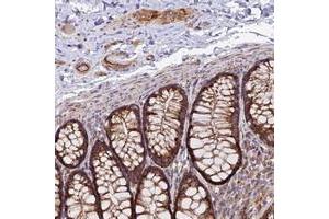 Immunohistochemical staining of human colon with TIGD6 polyclonal antibody  shows strong cytoplasmic positivity in glandular cells, endothelial cells and ganglion cells at 1:200-1:500 dilution. (TIGD6 antibody)