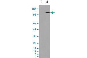 293 overexpressing MAN2A1 and probed with MAN2A1 polyclonal antibody  (mock transfection in first lane), tested by Origene. (alpha-Mannosidase II antibody  (Internal Region))