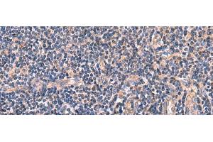 Immunohistochemistry of paraffin-embedded Human tonsil tissue using MYOT Polyclonal Antibody at dilution of 1:65(x200) (Myotilin antibody)