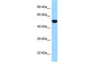 Image no. 1 for anti-Folylpolyglutamate Synthase (FPGS) (AA 265-314) antibody (ABIN6748112) (FPGS antibody  (AA 265-314))