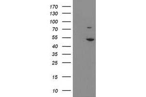 HEK293T cells were transfected with the pCMV6-ENTRY control (Left lane) or pCMV6-ENTRY EIF2B3 (Right lane) cDNA for 48 hrs and lysed. (EIF2B3 antibody)