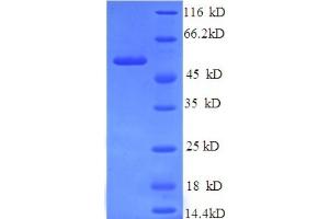 SDS-PAGE (SDS) image for Tyrosinase (TYR) (AA 19-377), (partial) protein (His tag) (ABIN4976584) (TYR Protein (AA 19-377, partial) (His tag))