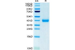 CD161 Protein (AA 67-227) (His-Avi Tag)