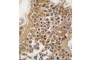 Formalin-fixed and paraffin-embedded human testis tissue reacted with ALK antibody (Center) (ABIN6243477 and ABIN6579002) , which was peroxidase-conjugated to the secondary antibody, followed by DAB staining. (ALK antibody  (AA 636-666))