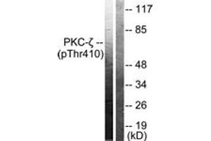 Western blot analysis of extracts from NIH-3T3 cells treated with PMA 125ng/ml 30', using PKC zeta (Phospho-Thr410) Antibody. (PKC zeta antibody  (pThr410))
