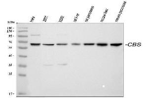 Western blot analysis of CBS using anti-CBS antibody (ABIN3043747). (CBS antibody  (AA 331-551))