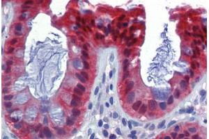 Human Colon (formalin-fixed, paraffin-embedded) stained with CASP7 antibody ABIN462357 followed by biotinylated anti-mouse IgG secondary antibody ABIN481714, alkaline phosphatase-streptavidin and chromogen. (Caspase 7 antibody)