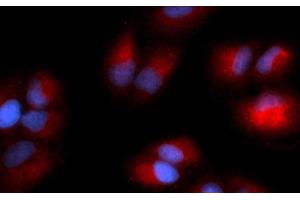 Immunofluorescence (IF) image for anti-Glycyl-tRNA Synthetase (GARS) (AA 43-289) antibody (PE) (ABIN5565503) (GARS antibody  (AA 43-289) (PE))