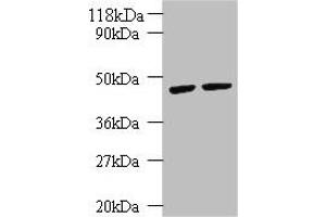Western blot All lanes: KRT18 antibody at 2 μg/mL Lane 1: K562 whole cell lysate Lane 2: HepG2 whole cell lysate Secondary Goat polyclonal to rabbit IgG at 1/10000 dilution Predicted band size: 49 kDa Observed band size: 49 kDa (Cytokeratin 18 antibody  (AA 102-396))