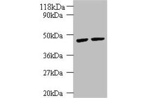 Western blot All lanes: KRT18 antibody at 2 μg/mL Lane 1: K562 whole cell lysate Lane 2: HepG2 whole cell lysate Secondary Goat polyclonal to rabbit IgG at 1/10000 dilution Predicted band size: 49 kDa Observed band size: 49 kDa (Cytokeratin 18 antibody  (AA 102-396))