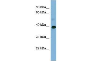 WB Suggested Anti-GAPDH Antibody Titration: 0. (GAPDH antibody  (Middle Region))