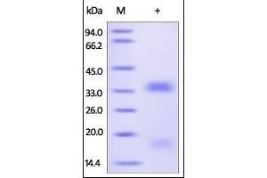VEGFB Protein (AA 22-207) (His tag)