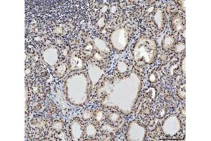 IHC analysis of CTBP2 using anti-CTBP2 antibody (ABIN7601326). (CTBP2 antibody  (AA 321-445))