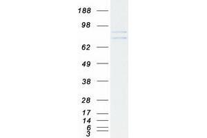 Validation with Western Blot