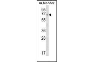 Western blot analysis of EYA1 Antibody (N-term) in mouse bladder tissue lysates (35ug/lane). (EYA1 antibody  (N-Term))