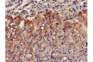 Immunohistochemistry of paraffin-embedded human adrenal gland tissue using ABIN7175304 at dilution of 1:100 (VPS29 antibody  (AA 68-145))