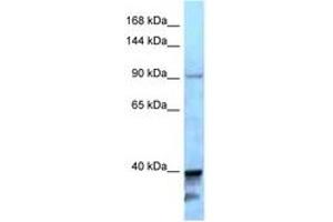 Image no. 1 for anti-Kinesin Family Member 7 (KIF7) (AA 1224-1273) antibody (ABIN6747946) (KIF7 antibody  (AA 1224-1273))