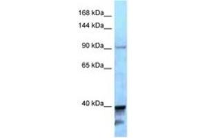 Image no. 1 for anti-Kinesin Family Member 7 (KIF7) (AA 1224-1273) antibody (ABIN6747946)