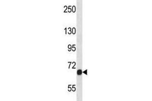 Fgfr1 antibody western blot analysis in NCI-H460 lysate. (FGFR1 antibody  (AA 756-784))