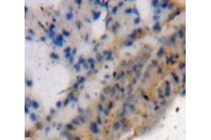 #VALUE! (ADAMTS4 antibody  (AA 437-575))