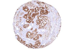 Kidney displaying a predominantly cytoplasmic PSAT1 staining of variable intensity in most tubuli