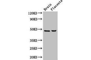 Western Blot Positive WB detected in: Mouse brain tissue, Human placenta tissue All lanes: CD177 antibody at 3 μg/mL Secondary Goat polyclonal to rabbit IgG at 1/50000 dilution Predicted band size: 47, 28, 16 kDa Observed band size: 47 kDa (CD177 antibody  (AA 22-321))