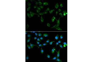 Immunofluorescence analysis of U2OS cells using TOLLIP antibody. (TOLLIP antibody  (AA 1-274))