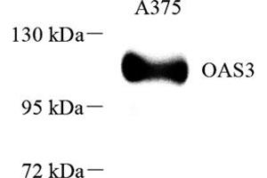 Western blot analysis of OAS3 (ABIN7072846),at dilution of 1: 1000