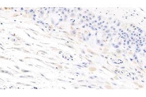Detection of IL7 in Human Placenta Tissue using Monoclonal Antibody to Interleukin 7 (IL7) (IL-7 antibody  (AA 26-177))