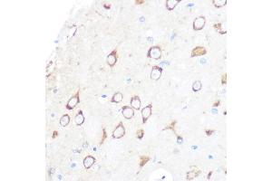 Immunohistochemistry of paraffin-embedded rat brain using MSR1 Rabbit mAb (ABIN7268353) at dilution of 1:100 (40x lens). (Macrophage Scavenger Receptor 1 antibody)