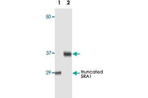 Western blot analysis using SRA1 monoclonal antibody, clone 7H1G1  against truncated SRA1 recombinant protein (1) and human ovarian cancer tissue lysate (2).