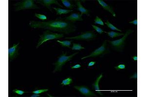 Immunofluorescence of monoclonal antibody to CBLL1 on HeLa cell. (CBLL1 antibody  (AA 1-100))