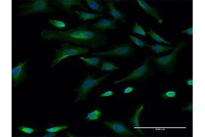 Immunofluorescence of monoclonal antibody to CBLL1 on HeLa cell.