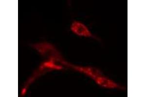 ABIN6274543 staining HeLa cells by IF/ICC.
